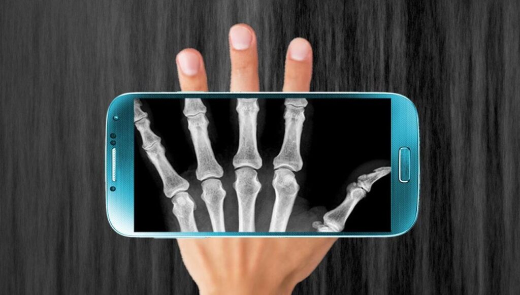 Radiographie par téléphone portable - Familiarisez-vous avec l'application et amusez-vous